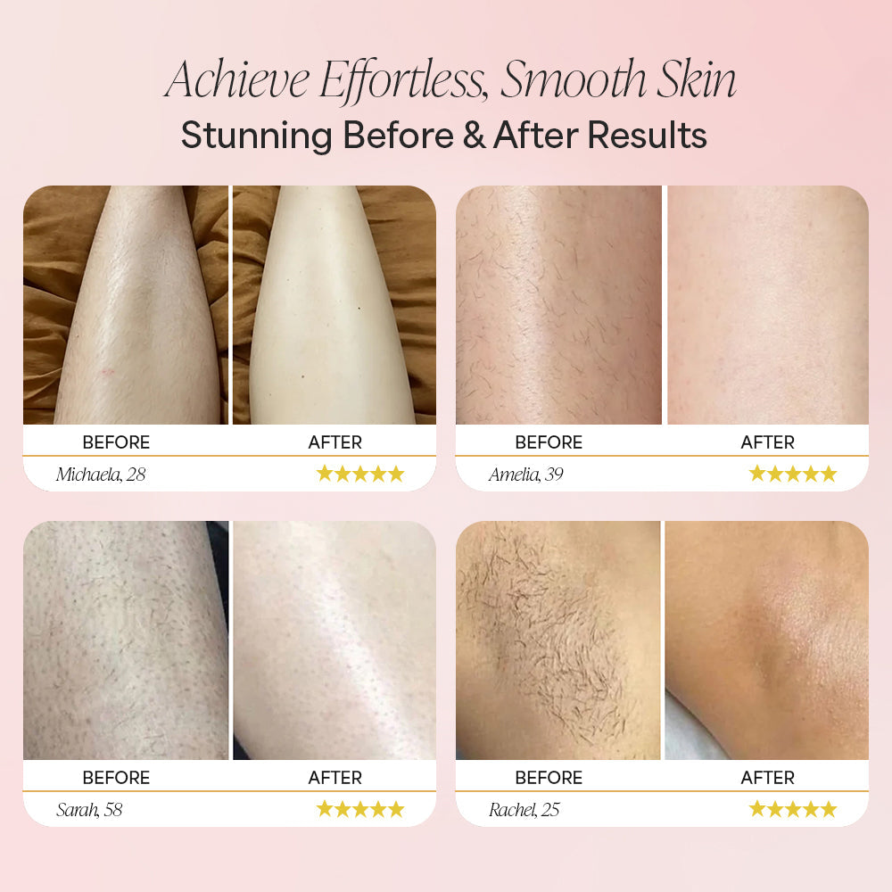 COMMONPLACE Trimmer 2.0